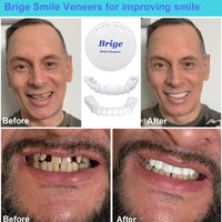 Snap On Smile Teeth Veneers