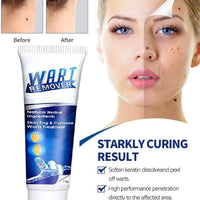 Wart Remover Gel